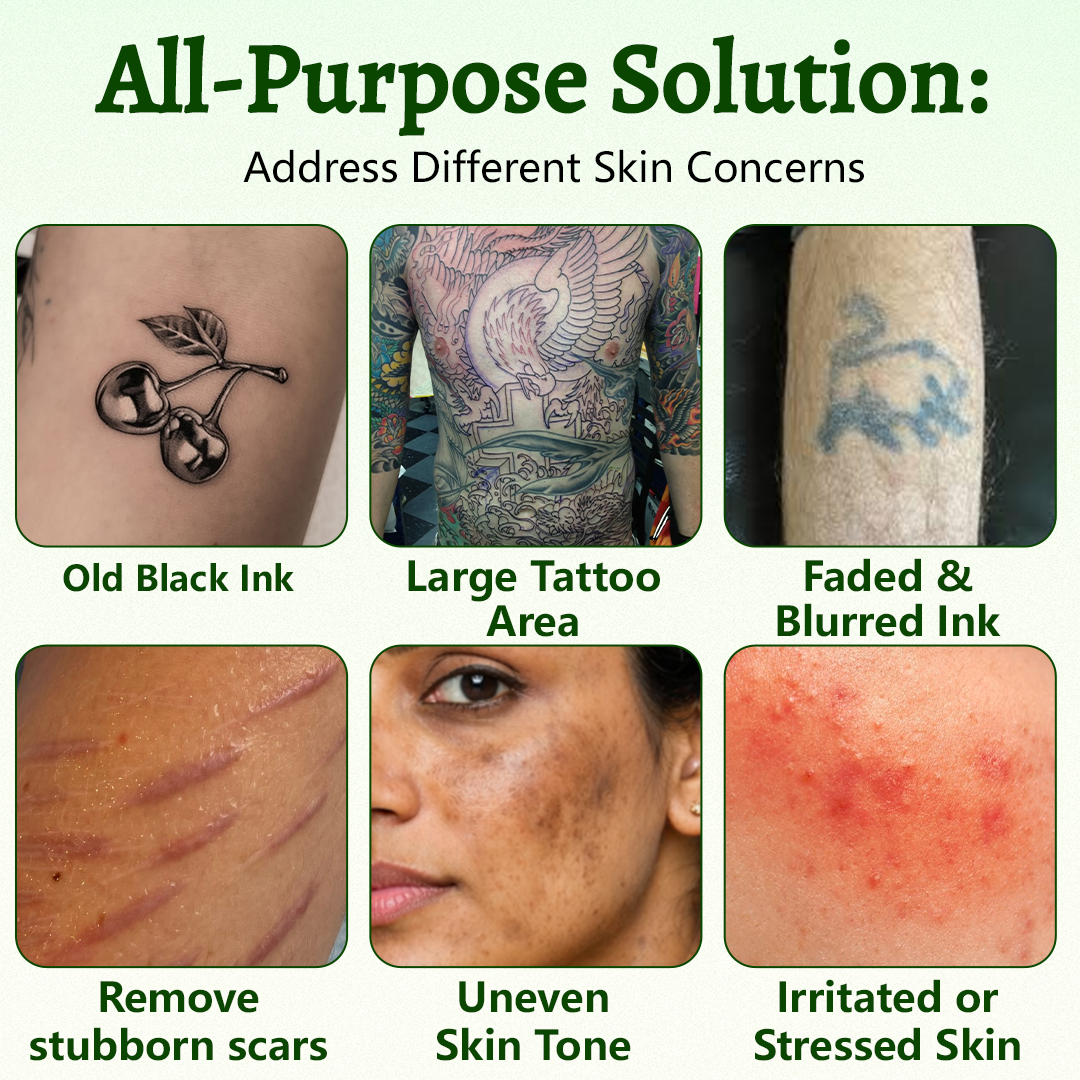Ceoerty® PureAlgae Ink Removal Support Spray 🌿 — Say Goodbye to Old Tattoo Pigment 💚, Fade Stubborn Ink ✨, Repair & Smooth Treated Skin 💧, Non-Laser ✅, Try It Now! 🔥（副本）