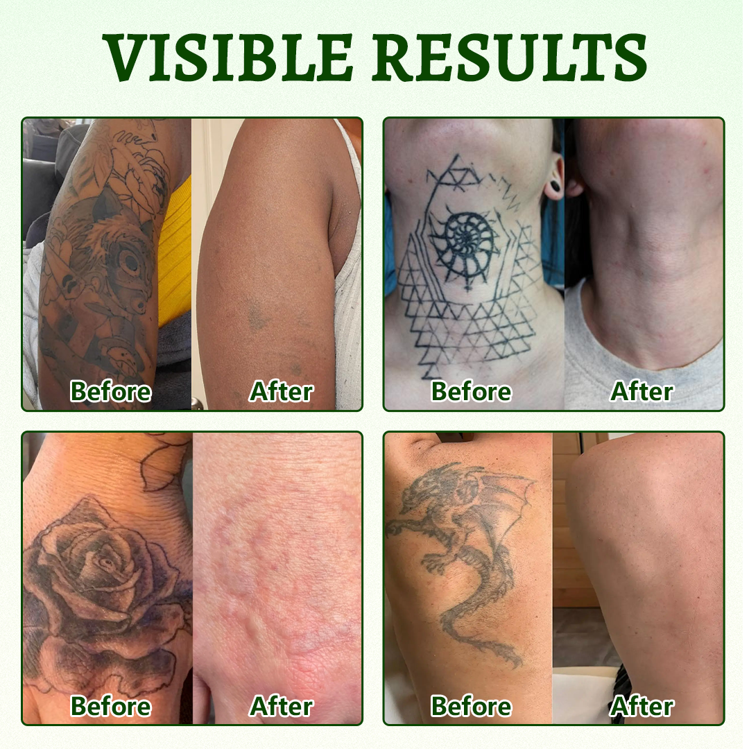 Ceoerty® PureAlgae Ink Removal Support Spray 🌿 — Say Goodbye to Old Tattoo Pigment 💚, Fade Stubborn Ink ✨, Repair & Smooth Treated Skin 💧, Non-Laser ✅, Try It Now! 🔥（副本）