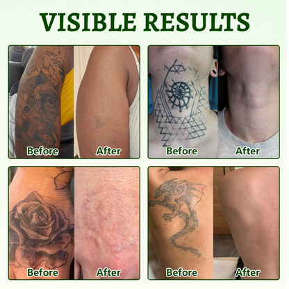 Ceoerty® PureAlgae Ink Removal Support Spray 🌿 — Say Goodbye to Old Tattoo Pigment 💚, Fade Stubborn Ink ✨, Repair & Smooth Treated Skin 💧, Non-Laser ✅, Try It Now! 🔥（副本）
